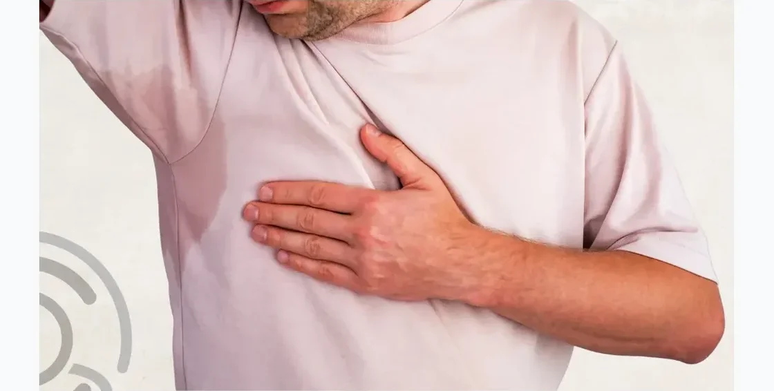 Hiperhidrosis